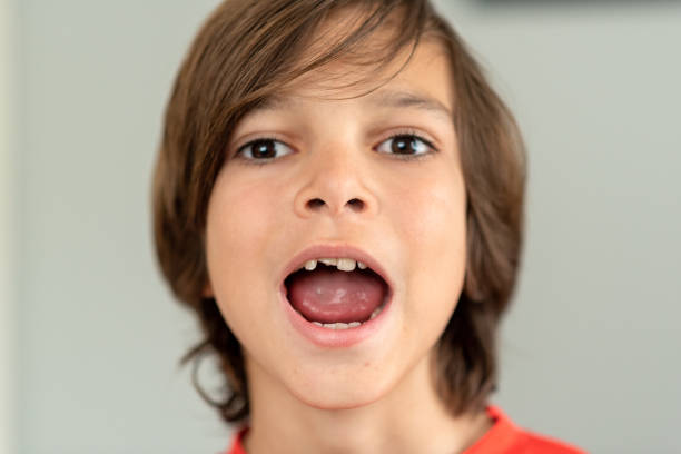 portrait of a boy with one of his front teeth broken off stock photo