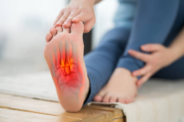 joint diseases, hallux valgus, plantar fasciitis, heel spur, woman's leg hurts, pain in the foot, massage of female feet at home - sole of foot imagens e fotografias de stock