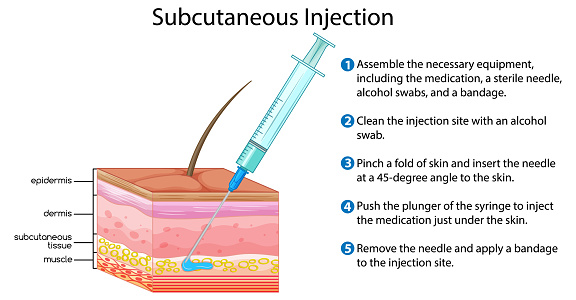 Subcutaneous Injection Tech Subcutaneous Injection With Explanation Stock Illustration - Download ...