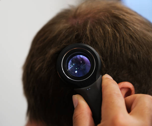 istock Close up hair transplant preparation on white background. 1478168207