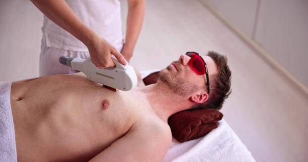 istock Man Laser Hair Removal 1478289206