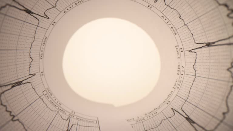 Closeup of electrocardiogram in paper form and bright light