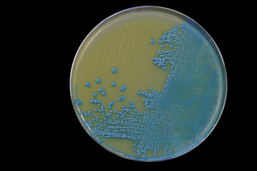 A listeria monocytogenes growing on an agar plate isolated on a black background