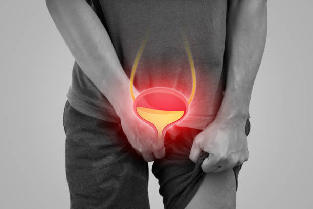 urinary hesitancy symptoms. - urinblåsa bildbanksfoton och bilder