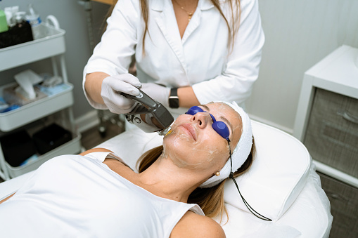 Woman getting real laser treatment