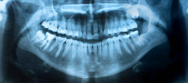 Dental X-Ray panoramic stock photo