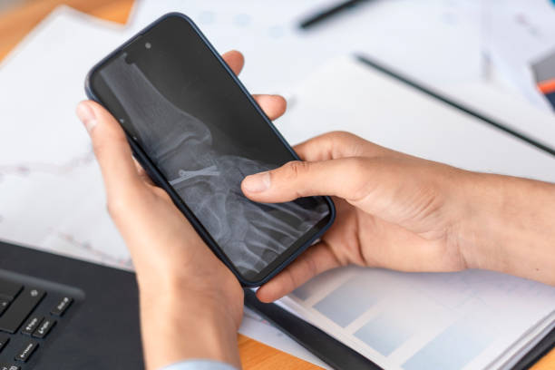 istock Close-up Man looking at x-ray image on phone 1479375712