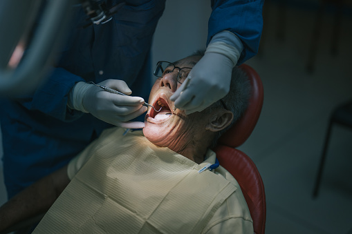 Close up Asian Chinese senior patient open mouth for dentist examining tooth routine check up