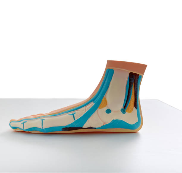 flatfoot. anatomical or educational model of foot with flat feet standing on table - plattfot bildbanksfoton och bilder