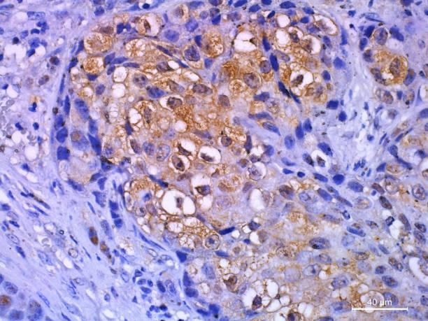 immunhistochemische färbung in der histopathologie - histology stock-fotos und bilder