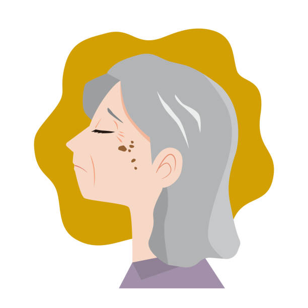 ilustrações, clipart, desenhos animados e ícones de mulher idosa com manchas - queratose