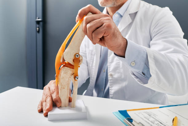 tratamento para lesões no joelho. modelo anatômico da articulação do joelho humano na mesa do médico no centro de ortopedia - clínica de treino desportivo - fotografias e filmes do acervo