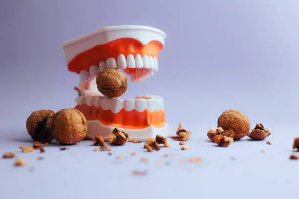 Photo of Denture Medical Model Biting into Hard Walnut Cracking the Shells