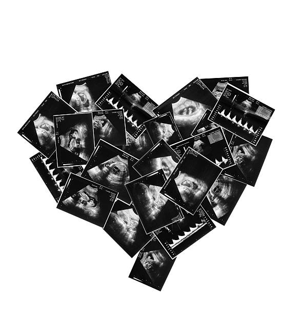 istock child on the ultrasound image 148053675
