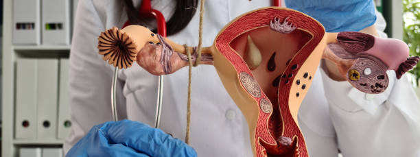 istock Gynecologist ligates fallopian tubes using model of female reproductive system as example 1480627768