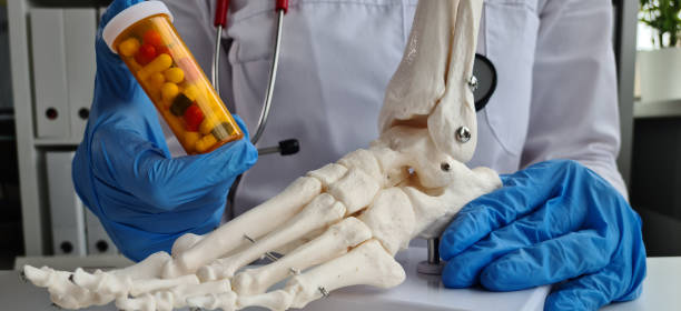 istock Orthopedist recommends medicine tablets for leg bones 1480628033