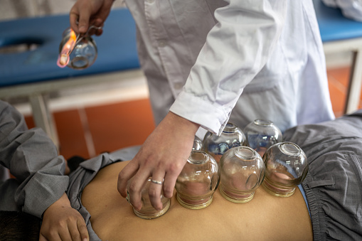 A person is undergoing traditional Chinese medicine cupping therapy