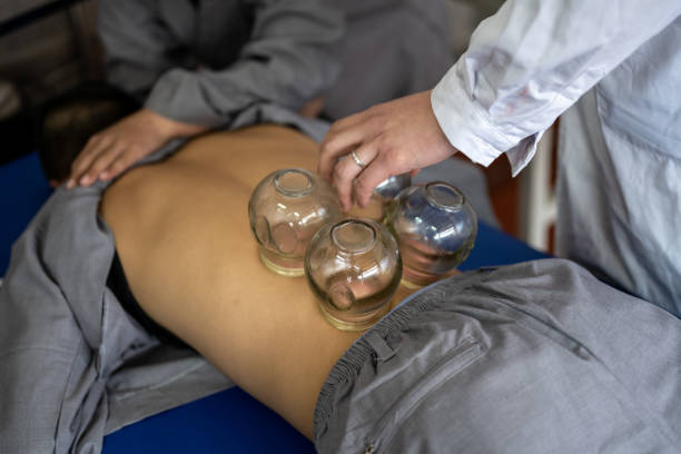 A person is undergoing traditional Chinese medicine cupping therapy