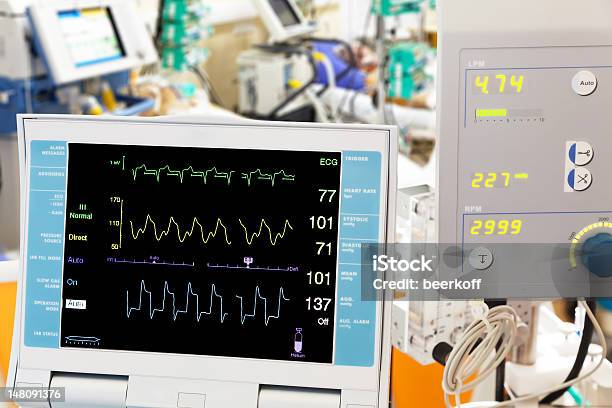 Cardiogram With Ecmo And Intraaortic Balloon Counterpulsation In Icu Stock Photo - Download Image Now