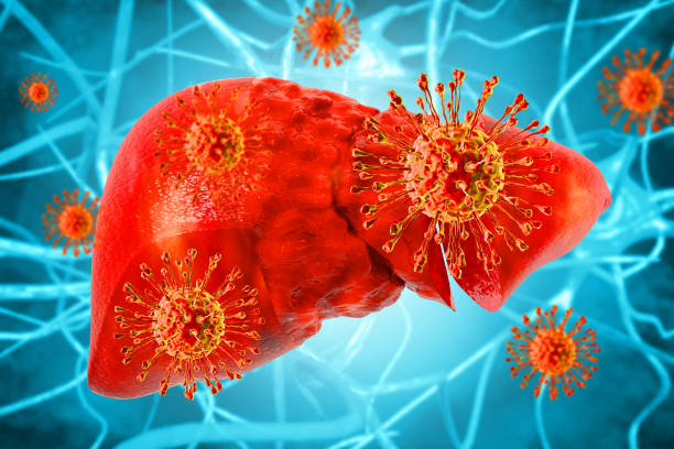 istock Hepatitis c virus infection. Liver disease. 3d illustration 1481136362