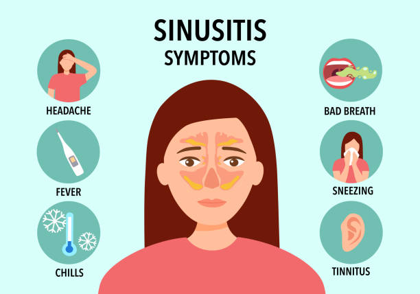 Sinusitis symptoms infographic concept vector illustration. vector art illustration
