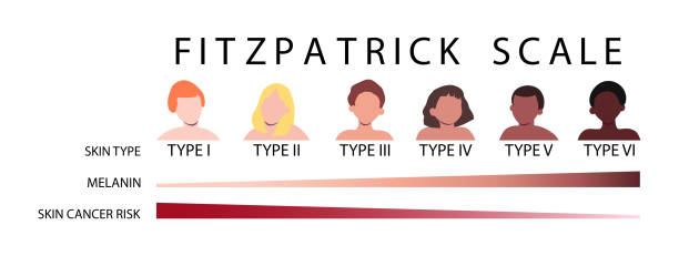 Fototyp Fitzpatrick Examples 20+ Fitzpatrick Skin Type Stock Photos, Pictures & Royalty-Free Images ...