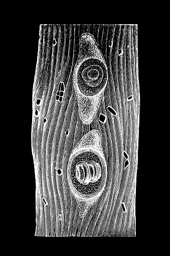 Trichina in the capsule of the muscle fibers