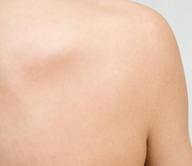 istock Woman spine 1481343525