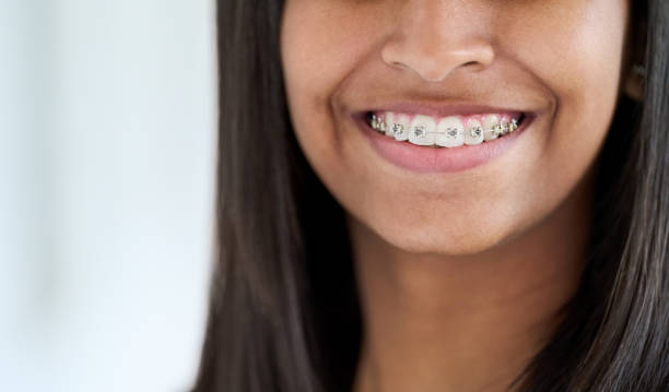 primo piano di una giovane donna sorridente con l'apparecchio dei denti - human mouth human teeth indoors young women foto e immagini stock