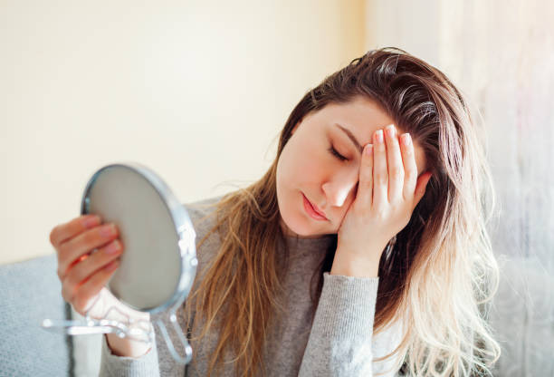 Stressed woman is sad about dirty oily and greasy hair looking in mirror at home. Healthcare. Hormonal imbalance stock photo