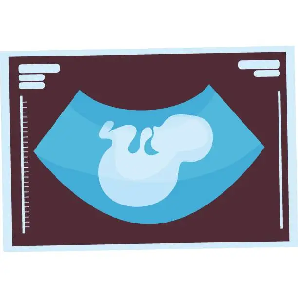 Vector illustration of Ultrasound picture of child