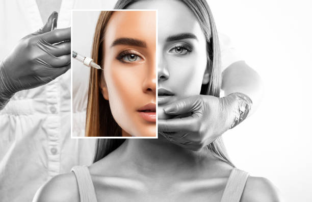 cosmetólogo hace inyecciones para el aumento de labios y antiarrugas en los pliegues nasolabiales de una mujer hermosa. cosmetología de mujer en el salón de belleza. - attractive female human collagen syringe injecting fotografías e imágenes de stock