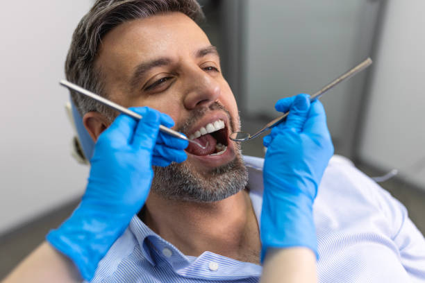 über die schulter eines zahnarztes, der die zähne eines patienten in der zahnklinik untersucht. mann lässt seine zähne von einer jungen zahnärztin untersuchen. - zahnarztpraxis stock-fotos und bilder