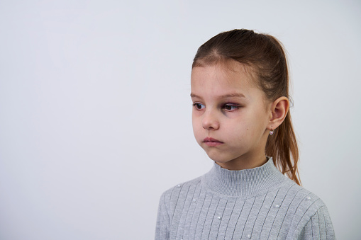 Little girl with bruises on face. Portrait of a child girl with facial hematoma, close-up