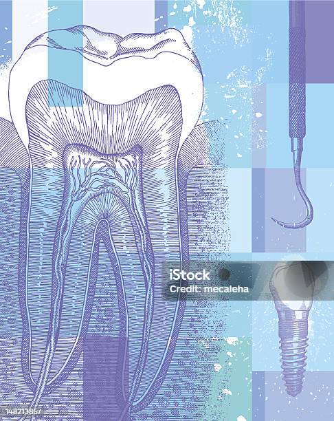 Ilustración de Diseño Dental y más Vectores Libres de Derechos de Instrumento de dentista - Instrumento de dentista, Salud dental, Fondos