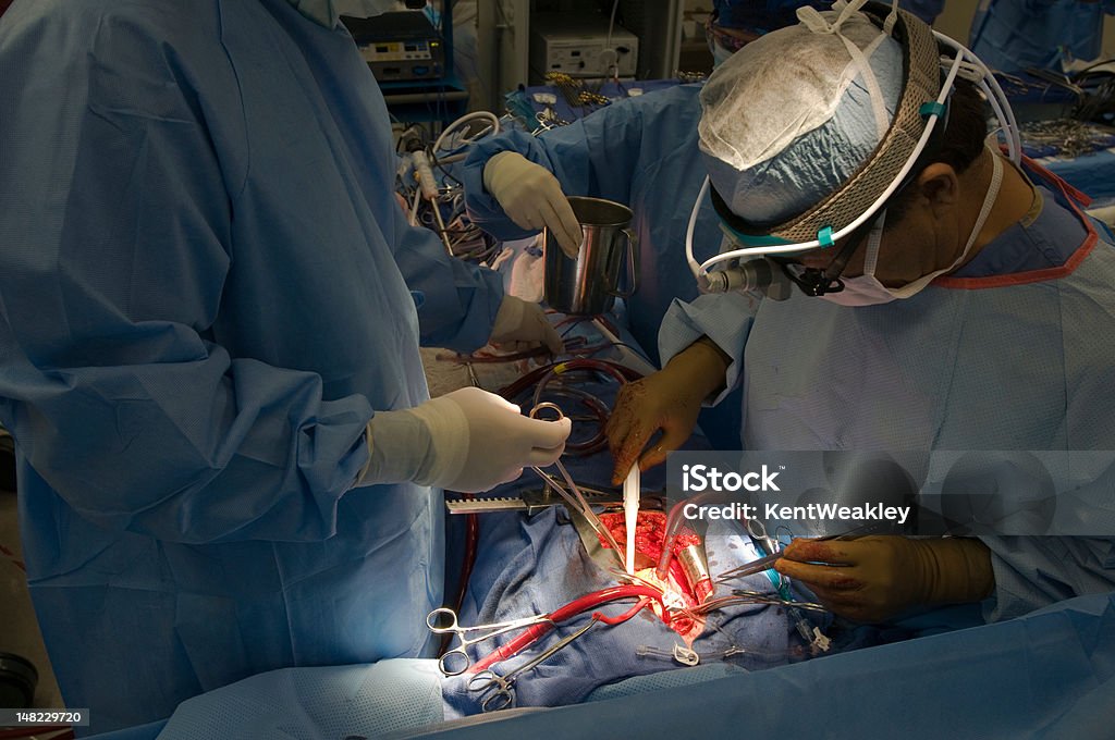 Ouvert cœur de contournement cardiaque opération - Photo de Chirurgien libre de droits