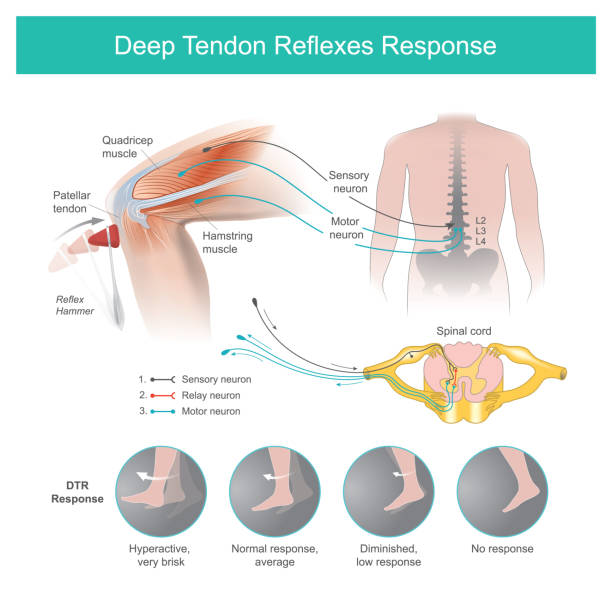 respons refleks tendon dalam. - tendon ilustrasi stok