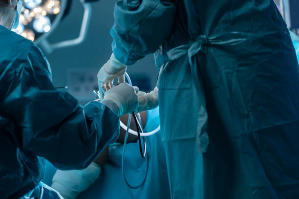 膝の手術の穿刺で忙しい医師の手の接写、手術を受けている患者、手術を受けている手術器具の外科医を拾う医師の助手、迅速なタイムリーな手術。 - gauze scalpel surgeon healthcare and medicine ストックフォトと画像