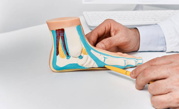 anatomical flat foot model on doctor table while consultation in orthopedics center. treatments for flat feet and pes planus - plattfot bildbanksfoton och bilder