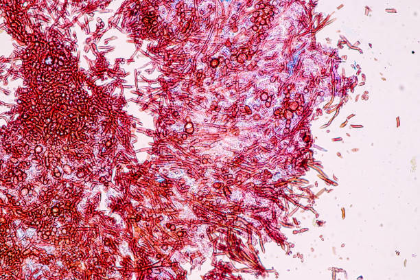 istock Host cells with spores (mold) are inside wood. 1482722011