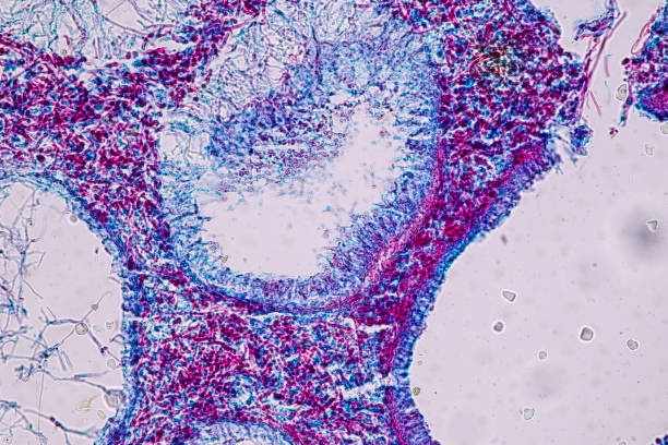 istock Host cells with spores (mold) are inside wood. 1482722037