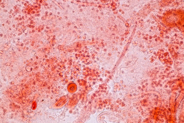 istock Host cells with spores (mold) are inside wood. 1482722121