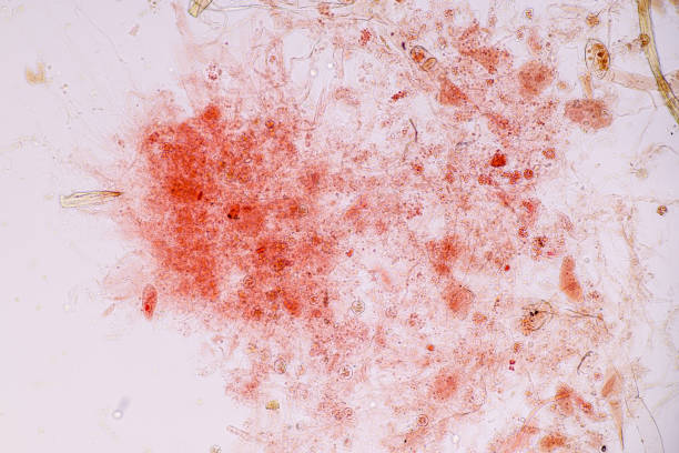 Host cells with spores (mold) are inside wood. Host cells with spores (mold) are inside wood under the microscope for education. conidia stock pictures, royalty-free photos & images