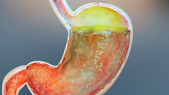human stomach with gases. Bloating and flatulence, flatulence and gastrointestinal tract, Bloating digestion system, stomach ache or cramps, gastritis, stomachache, indigestion, vomiting, 3d render