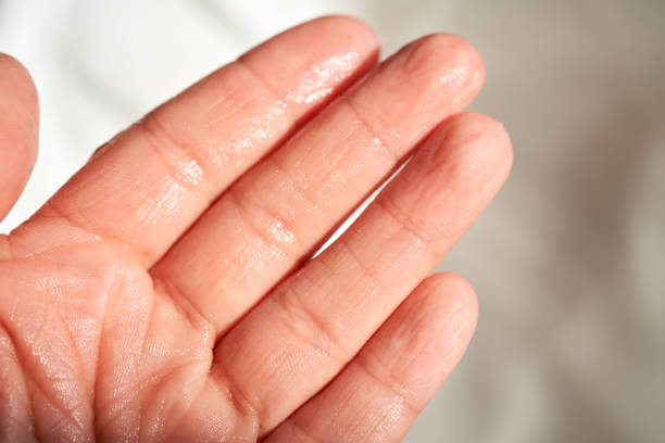 istock Fingers of the hand after using a moisturizer. 1482797905