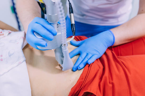 istock scar removal treatment on stomach 1482857807