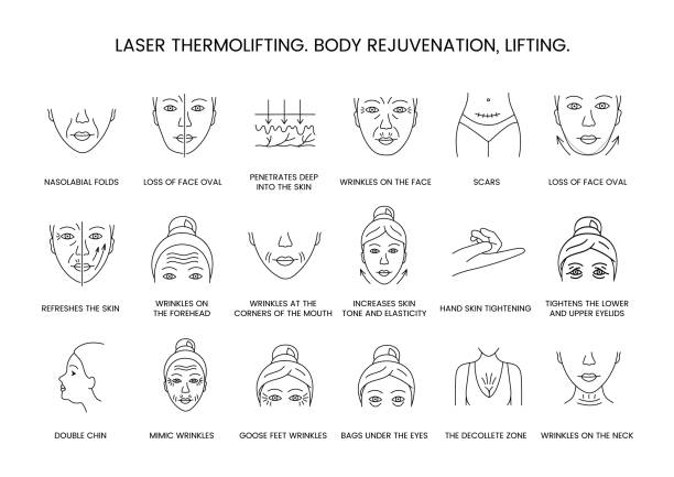 stockillustraties, clipart, cartoons en iconen met laser thermolifting, body rejuvenation and lifting, line icon set in vector, illustration of nasolabial folds and loss of face oval, penetrates deep into the skin, increases skin tone and elasticity. - aanhalen
