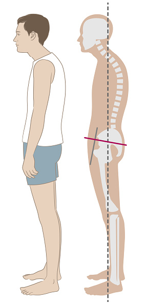 Stoopingly Sideways Man And Skeleton Standing In A Stooped Posture Stock ...