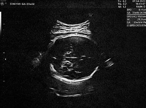 Unrecognizable pregnant woman is showing colored ultrasound picture of her baby in hands.