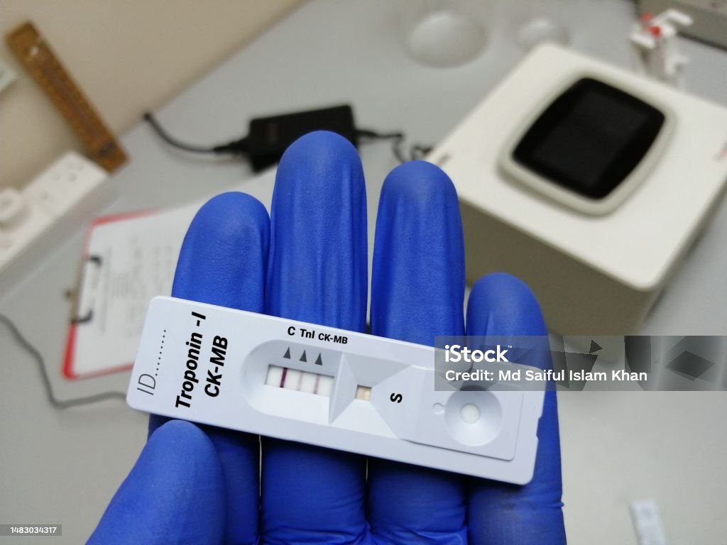Scientist holding rapid test cassette for Troponin-I and CK-MB test, myocardial infraction. Analyzing Stock Photo